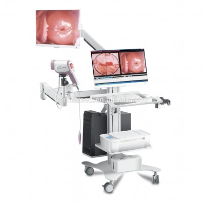 KN2200I HD DIGITAL Video Colposcope with CE mark for vagina cervix gynecology examination