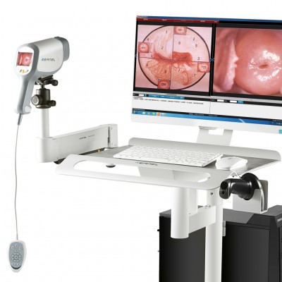 Kernel KN-2200I HD digital video colposcope imaging system