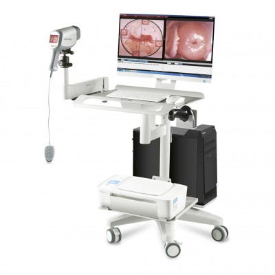 Digital HD Vagina Colposcope for Gynecology/Video Colposcope For Vagina KN-2200I