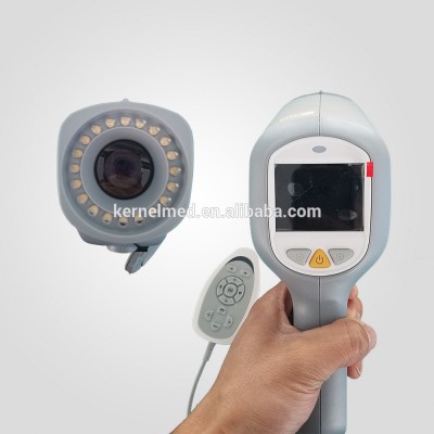 Clinical vaginal ccd camera digital video colposcope for gynecology