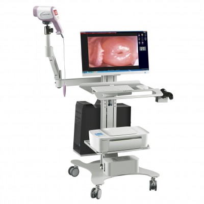 HD digital Video Colposcope for obs&gyn