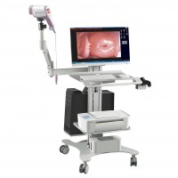 HD digital Video Colposcope for obs&gyn